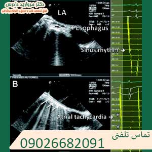 انجام اکو قلب شماره تماس