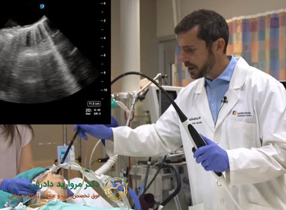 مراحل انجام اکو مری