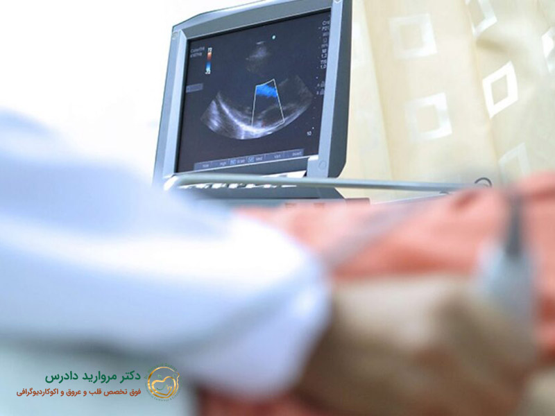 اکوکاردیوگرافی داپلر