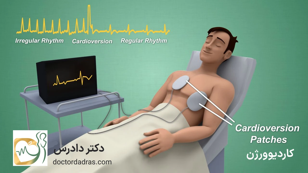 کاردیوورژن قلبی یا شوک قلبی چیست ؟