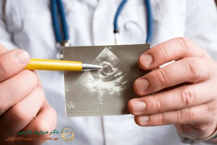 نارسایی دریچه تریکوسپید قلب چه علائمی دارد؟