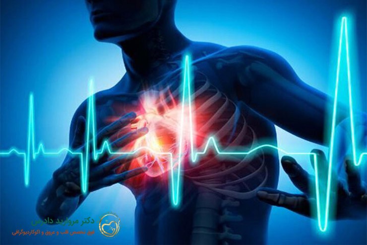 فیبریلاسیون دهلیزی چیست؟