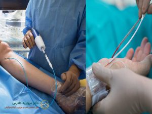 آنژیوگرافی از دست بهتر است یا پا