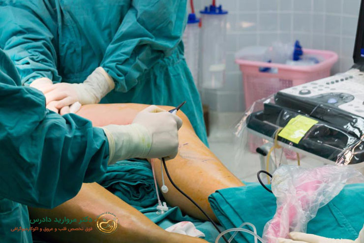 توضیح آنژیوگرافی از طریق پا