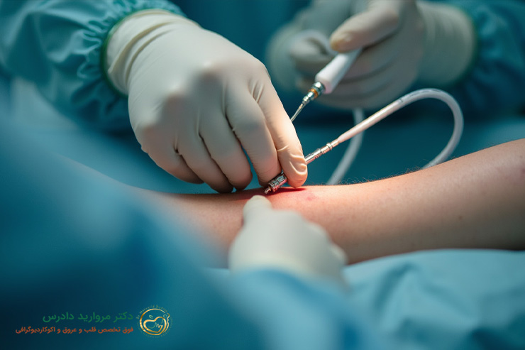 آنژیوگرافی از دست بهتر است یا پا چه روش های جایگزینی وجود دارد؟