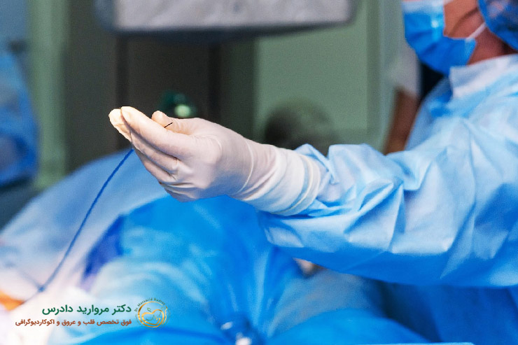 تفاوت آنژیوگرافی و آنژیوپلاستی قلب از نظر دوران نقاهت